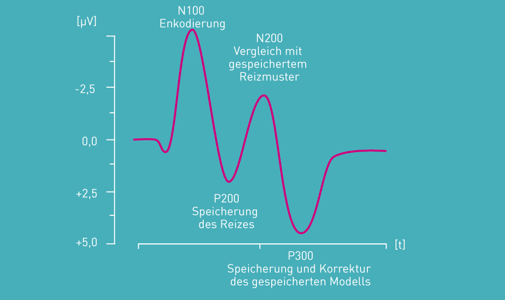 Schematische Darstellung des Verlaufs ereigniskorrelierter Potentiale bei Aufnahme und Verarbeitung eines visuellen oder auditiven Reizes 